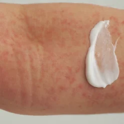 EXTRODERM HAUTBALSAM Kennenlerngröße
