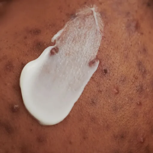 PURDERM Waschcreme