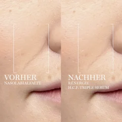 Rénergie H.C.F. Triple Serum