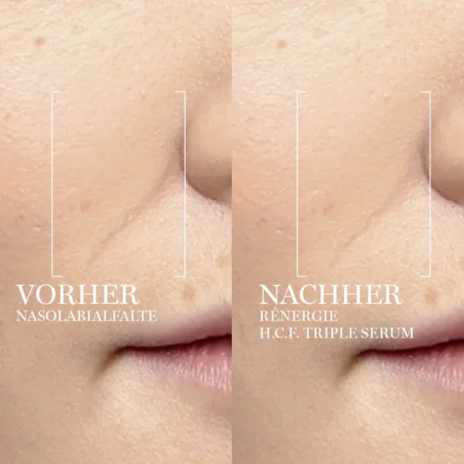 Rénergie H.C.F. Triple Serum