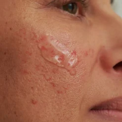 SENSACEA Intensivserum